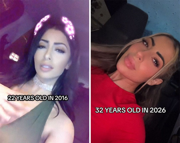Side-by-side comparison photos showing a woman's transformation from 22 years old in 2016 to 32 years old in 2026.