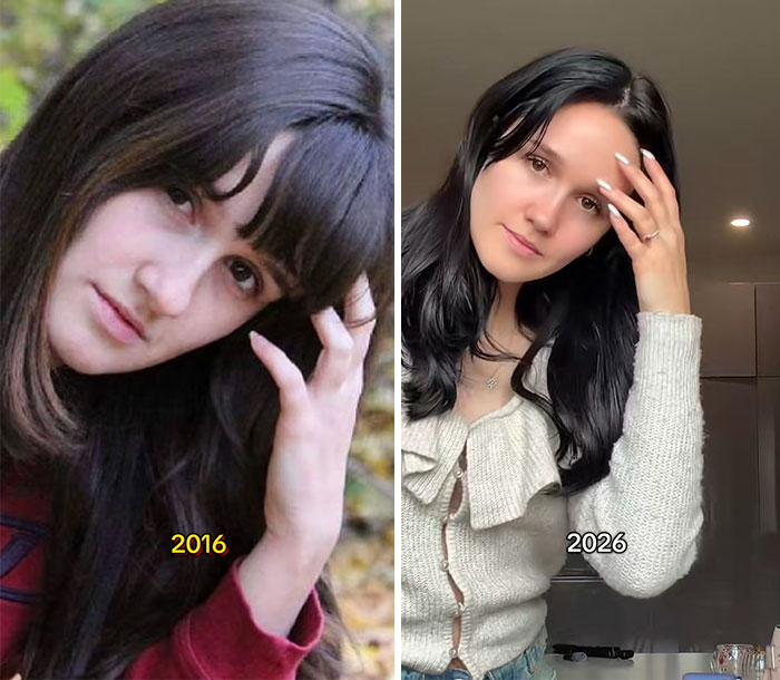Side-by-side photos of a woman from 2016 and 2026 showing a noticeable transformation over ten years.