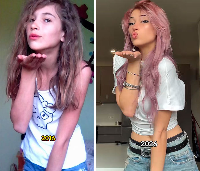 Side-by-side comparison of a woman in 2016 and 2026 showing changes over ten years in appearance.