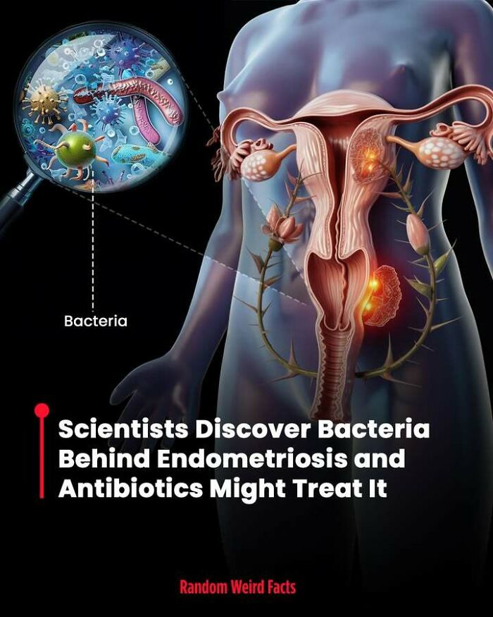 Human female reproductive system illustration with bacteria magnified, highlighting endometriosis and potential antibiotic treatment facts.