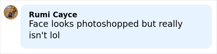 Comment on Amy Schumer trolling herself shortly after divorce filing amid backlash over bikini photos.