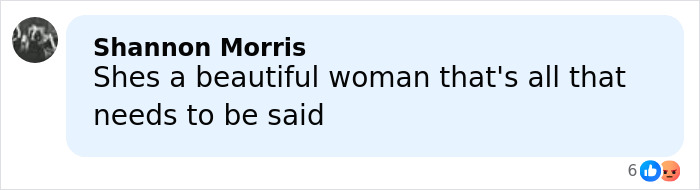 "Brunette Sydney Sweeney": Billie Eilish New Look Sparks Buzz As She Admits She Never 'Felt Beautiful'