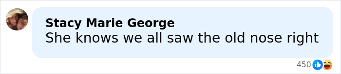 "Hand Her A Mirror": Kendall Jenner Draws Scrutiny After Denying Plastic Surgery Rumors "Hand Her A Mirror": Kendall Jenner Draws Scrutiny After Denying Plastic Surgery Rumors