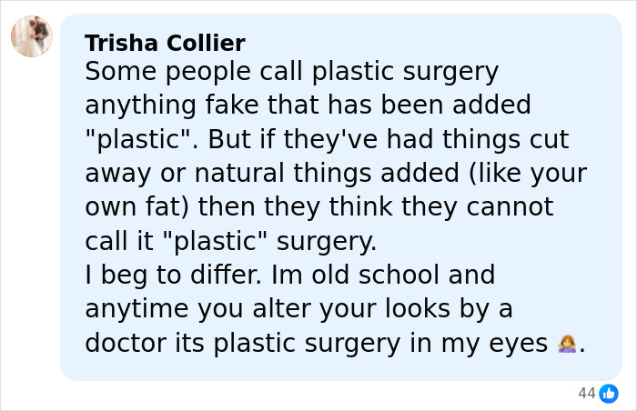 "Hand Her A Mirror": Kendall Jenner Draws Scrutiny After Denying Plastic Surgery Rumors "Hand Her A Mirror": Kendall Jenner Draws Scrutiny After Denying Plastic Surgery Rumors