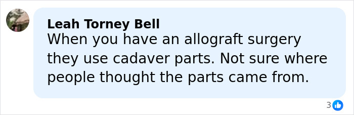 Comment about allograft surgery using cadaver parts for breast implants and BBL procedures, clarifying tissue sources. Comment about allograft surgery using cadaver parts for breast implants and BBL procedures, clarifying tissue sources.