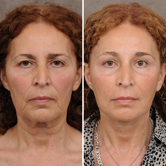 Plastic Surgeon Goes Viral After Dry Response To Facelift Critic Leaves Internet Laughing Hard