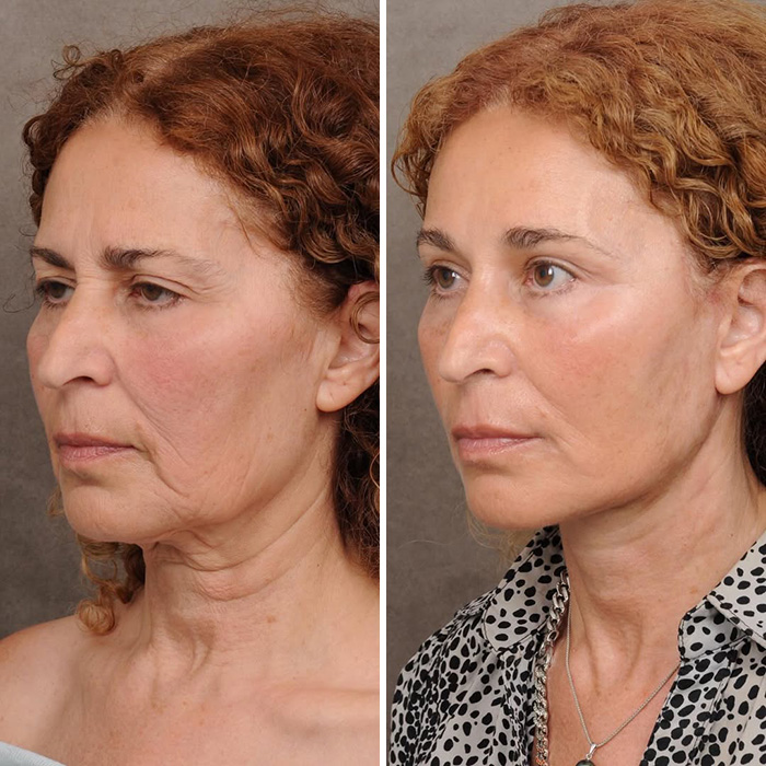 Plastic Surgeon Goes Viral After Dry Response To Facelift Critic Leaves Internet Laughing Hard