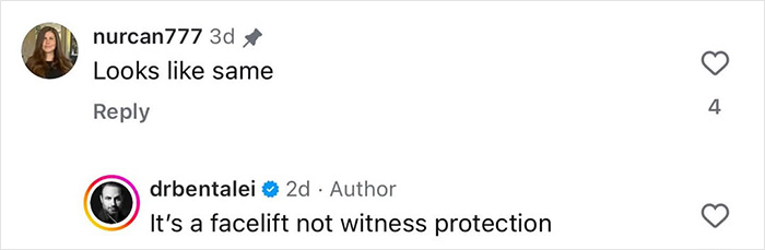 Plastic Surgeon Goes Viral After Dry Response To Facelift Critic Leaves Internet Laughing Hard