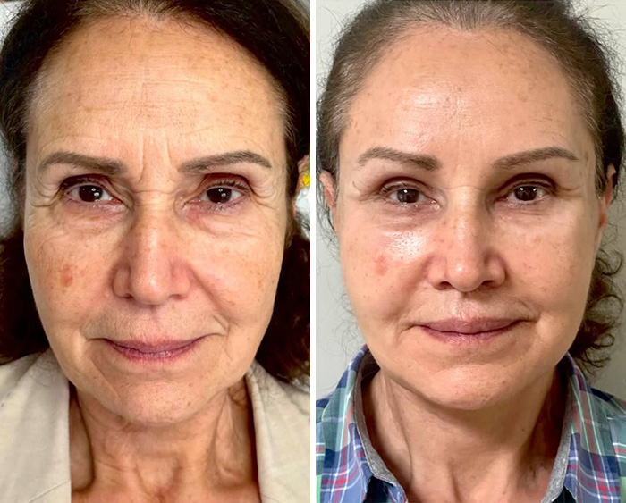 Plastic Surgeon Goes Viral After Dry Response To Facelift Critic Leaves Internet Laughing Hard