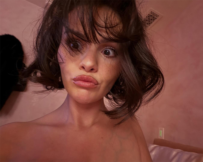 Selena Gomez with tousled hair making a surprised face, fans blaming plastic surgery for her transformation.