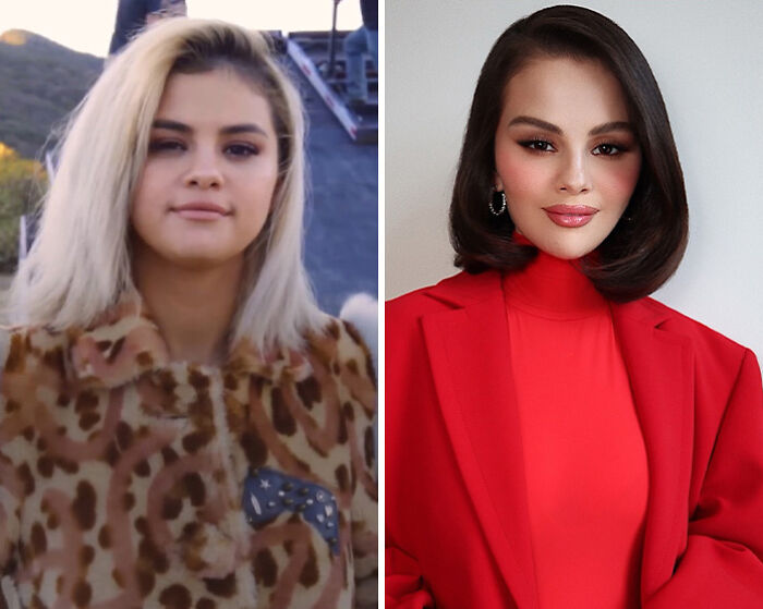 Side-by-side images of Selena Gomez showing a dramatic transformation fans blame on plastic surgery changes.