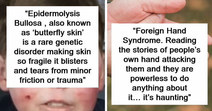 People Are Sharing The Worst Diseases They Know And These 38 Are Truly Horrible