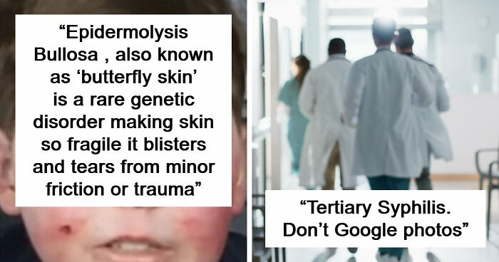 People Are Sharing The Worst Diseases They Know And These 38 Are Truly Horrible