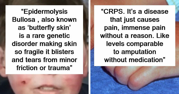 People Are Sharing The Worst Diseases They Know And These 38 Are Truly Horrible