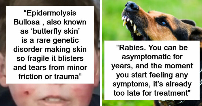 38 Of The Most Horrible Diseases And Illnesses Known To Mankind