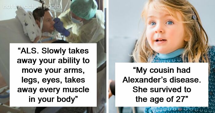 “Can’t Be Cured”: 38 Absolutely Heartbreaking Medical Conditions That No Person Deserves To Have