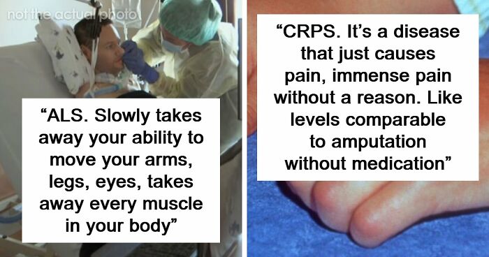 “Can’t Be Cured”: 38 Absolutely Heartbreaking Medical Conditions That No Person Deserves To Have