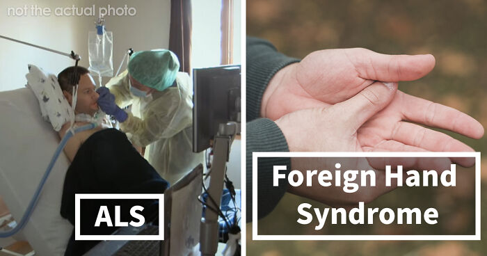 “Can’t Be Cured”: 38 Absolutely Heartbreaking Medical Conditions That No Person Deserves To Have