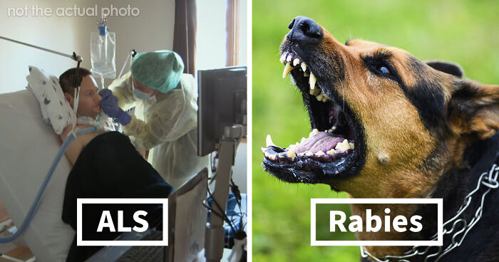 “Can’t Be Cured”: 38 Absolutely Heartbreaking Medical Conditions That No Person Deserves To Have