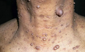 38 Diseases That Are The Worst Of The Worst