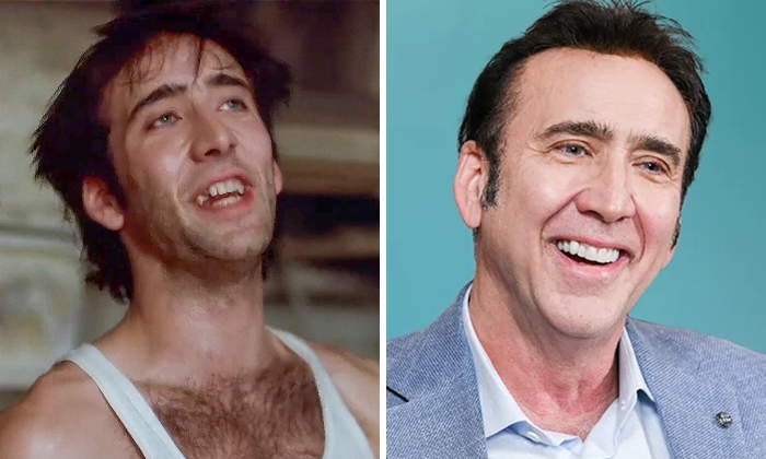 Nicolas Cage Side-by-side images of a male celebrity before and after dental implant makeover showing improved smile and teeth gaps filled.