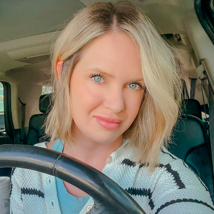 Proprietário de uma boutique com lábios perceptíveis realçados sentado em um carro, provocando um escândalo na cidade com o crescimento dos lábios em fotos.