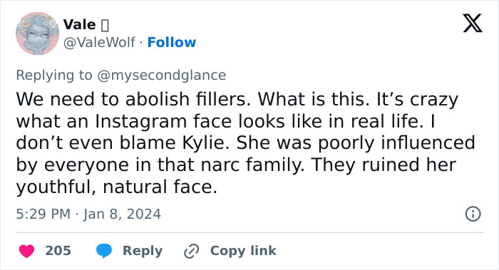 Screenshot of a social media comment discussing Kylie Jenner's natural face and fillers, referencing her 2026 BAFTAs appearance.