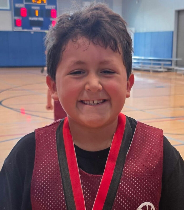 Smiling young boy in basketball jersey with red medal inside a gym, related to 9-year-old severe facial burns TikTok trend.