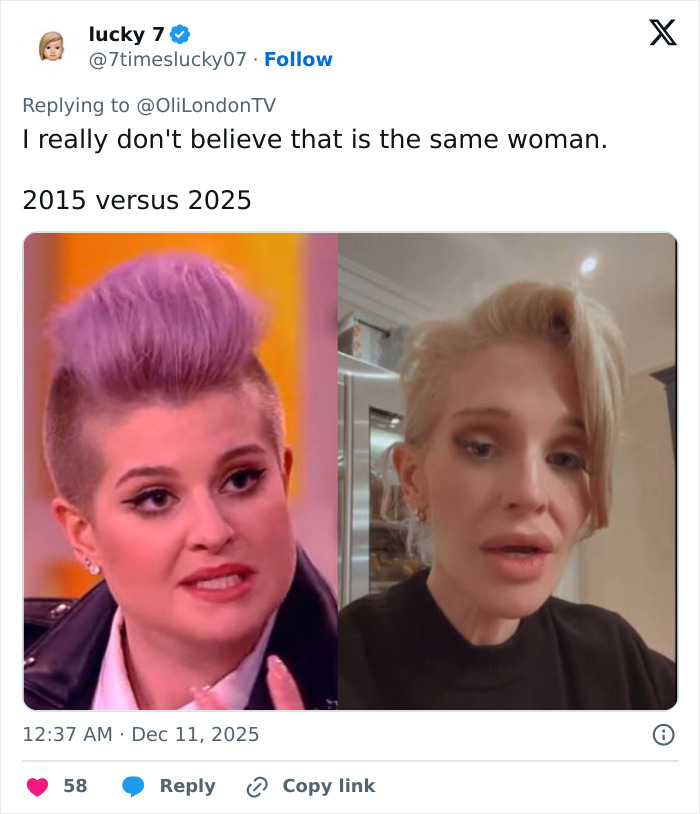 Side-by-side photos of Kelly Osbourne showing her latest look and dramatic change from 2015 to 2025.