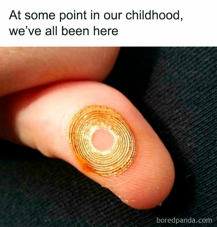 Close-up of a finger with a worn circular adhesive bandage representing nostalgic childhood memories.