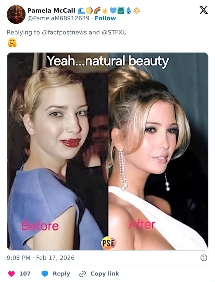 Side-by-side before and after photos of Ivanka Trump highlighting her transformation and doctors&rsquo; work.