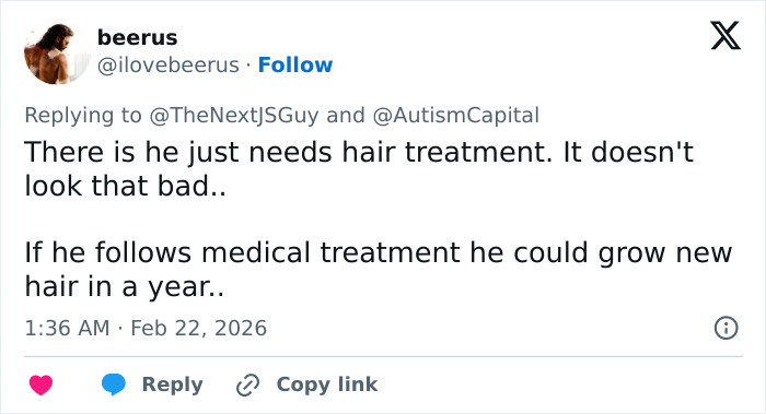 Tweet discussing influencer humiliated after getting his wig snatched, suggesting medical hair treatment for regrowth.