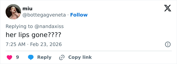 Kylie Jenner's appearance at the 2026 BAFTAs sparking fan discussion about her lips and major details.