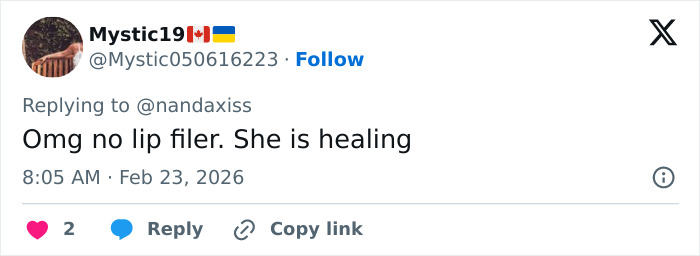 Tweet comment discussing Kylie Jenner's lip filler healing spotted by fans during 2026 BAFTAs appearance.