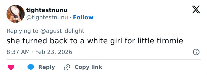 Fan tweet reacting to Kylie Jenner&rsquo;s appearance commenting on her lip transformation at the 2026 BAFTAs event.