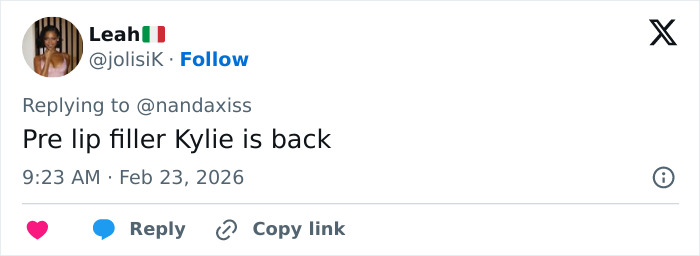 Screenshot of a tweet discussing Kylie Jenner&rsquo;s appearance and lip filler at the 2026 BAFTAs event.