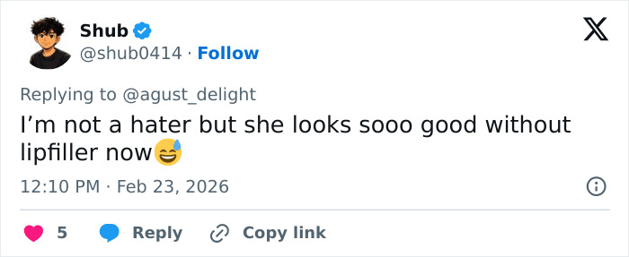 Tweet text mentioning Kylie Jenner's appearance without lip filler, noting fans spot major detail at the 2026 BAFTAs.