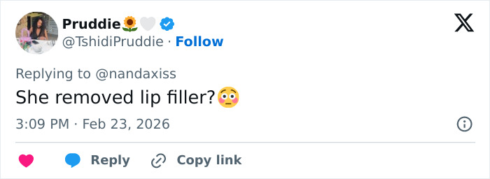 Tweet questioning if Kylie Jenner dissolved her lip filler, sparking fan discussion after her 2026 BAFTAs appearance.