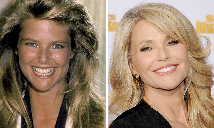 Side-by-side images showing a Christie Brinkley before and after a dental implant makeover, highlighting smile transformation.