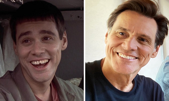 Jim Carrey Before and after celebrity dental implant makeover showing improved smile and gap closure with natural-looking teeth transformation.