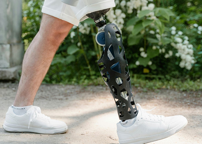 Close up of a person with a prosthetic leg wearing white sneakers walking outdoors, illustrating today I messed up stories.