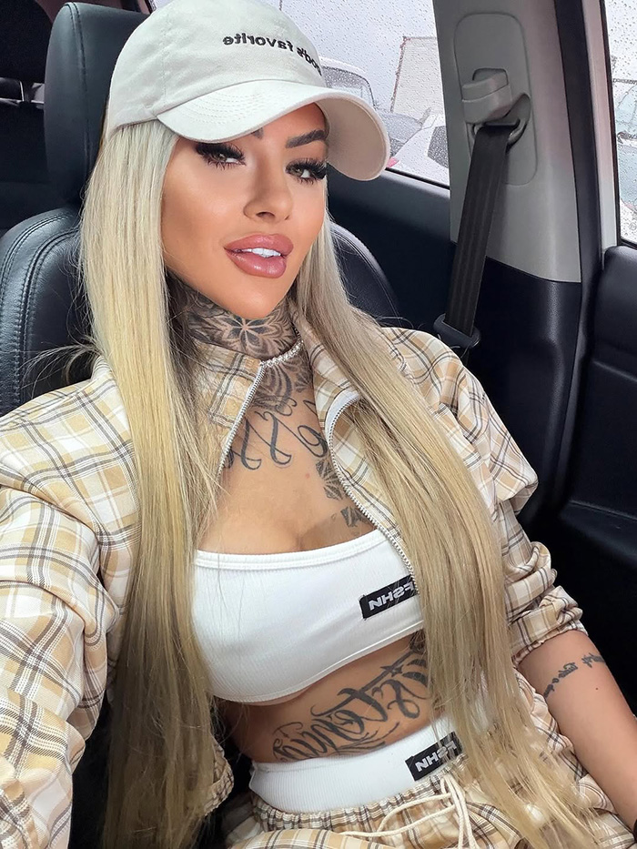 Influenciador glamoroso morre aos 27 anos após complicações de uma grande cirurgia plástica