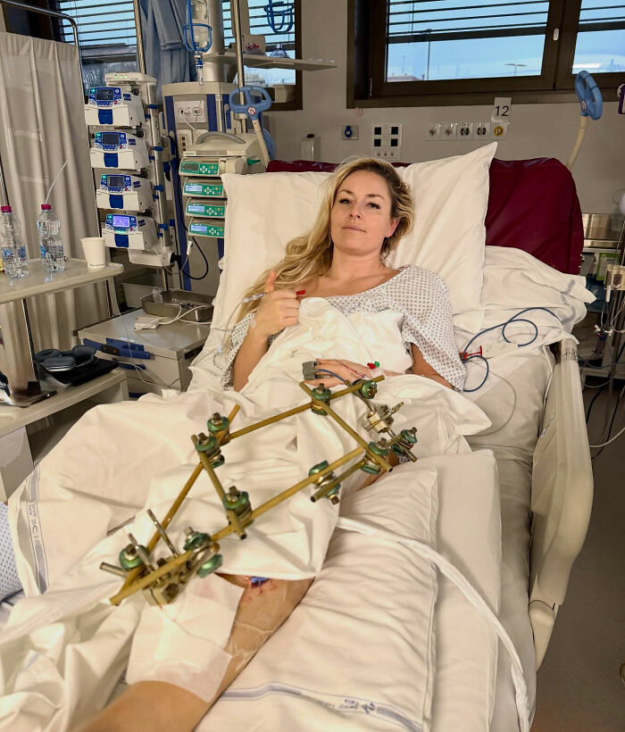 Lindsey Vonn in hospital bed with leg brace after horrific crash, facing possible leg amputation and major recovery update.