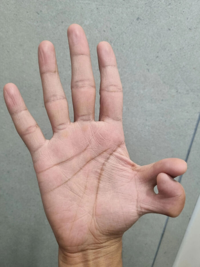 An amazing photo of a person's hand with an unusual, very flexible thumb. This picture might brighten your day.