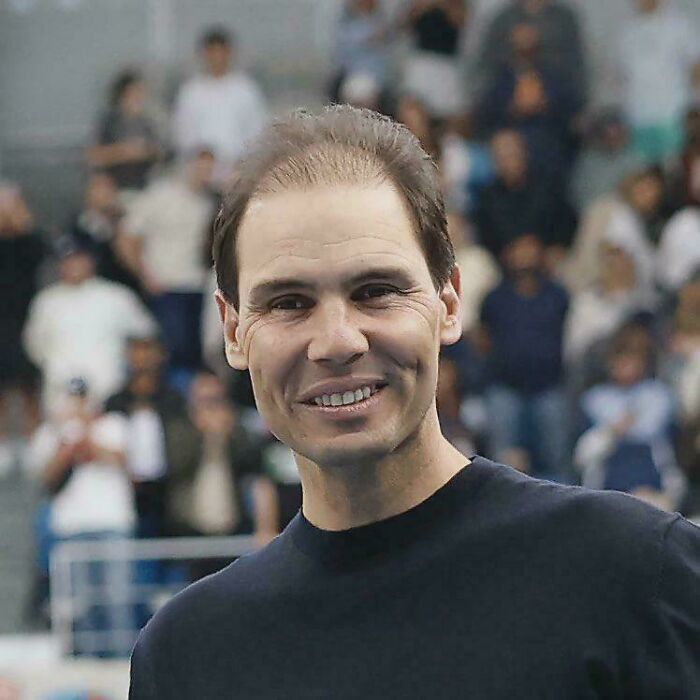 Rafael Nadal smiling on a tennis court, displaying a noticeably thinning hairline and an unfortunate haircut.