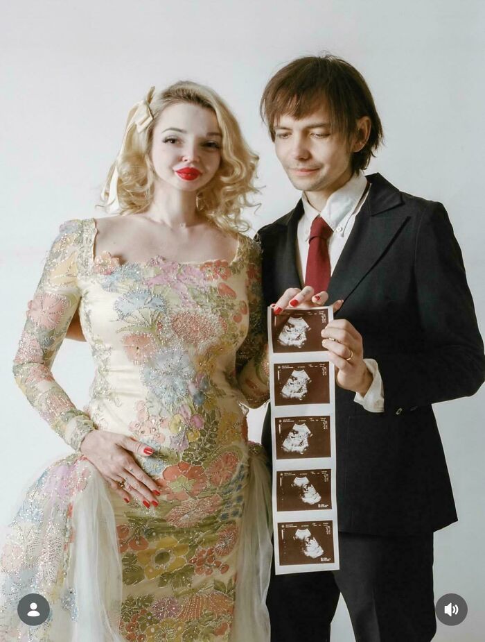 A pregnant woman and a man hold ultrasound photos, creating an unnatural social media pose.