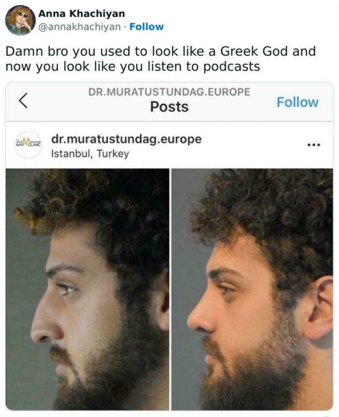 Before and after profile photos showing a man's nose transformation, one of 97 unhinged sentences images that leave everyone speechless.