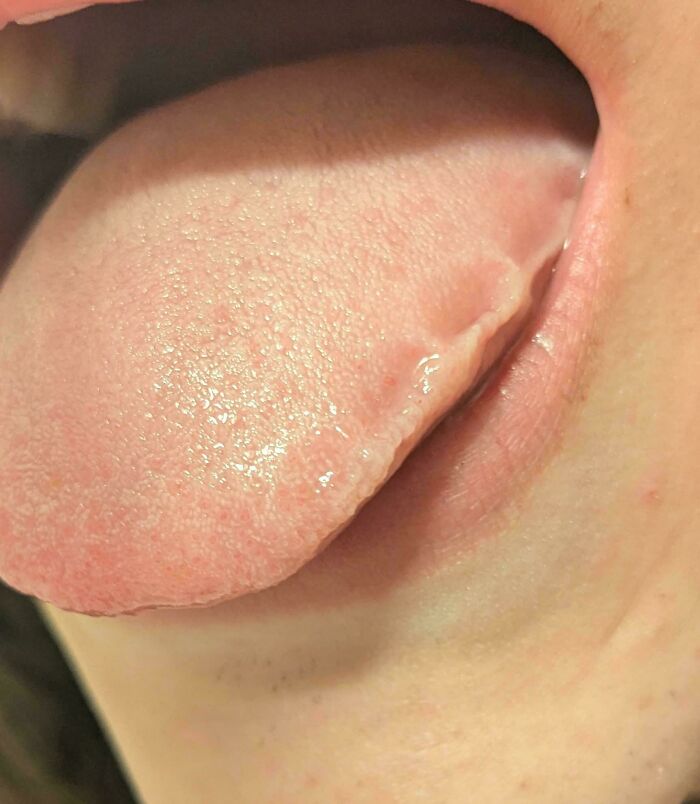 A close-up view of a human tongue showing its surface and edges, making for an interesting picture.