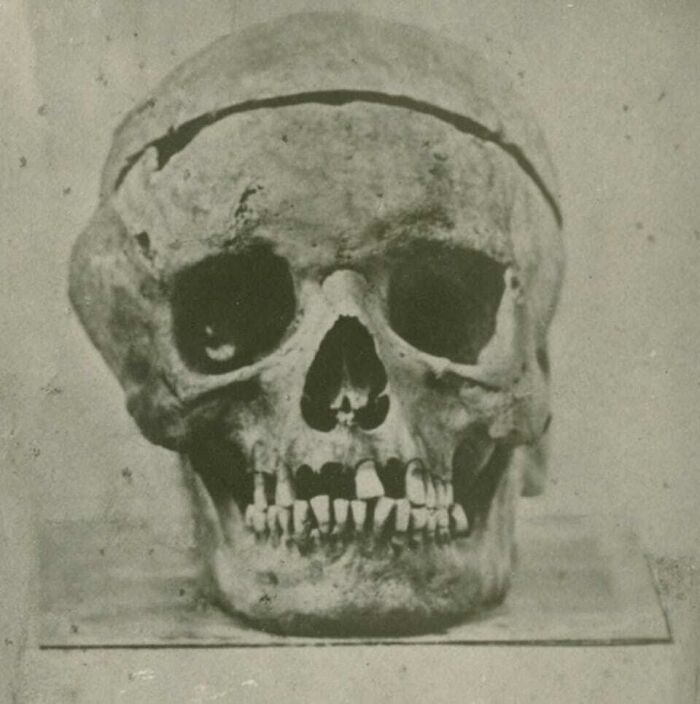 Human skull used in scientific skull scans and portraits to recreate the faces of Mozart, Bach, and Beethoven.