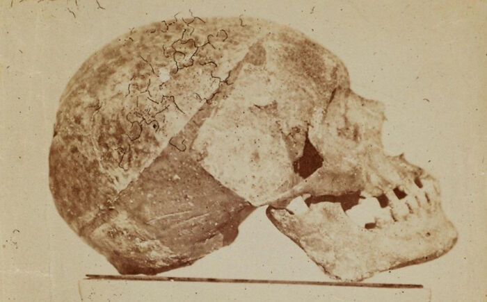 Skull scan of a historic figure used by a scientist to recreate faces of Mozart, Bach, and Beethoven.